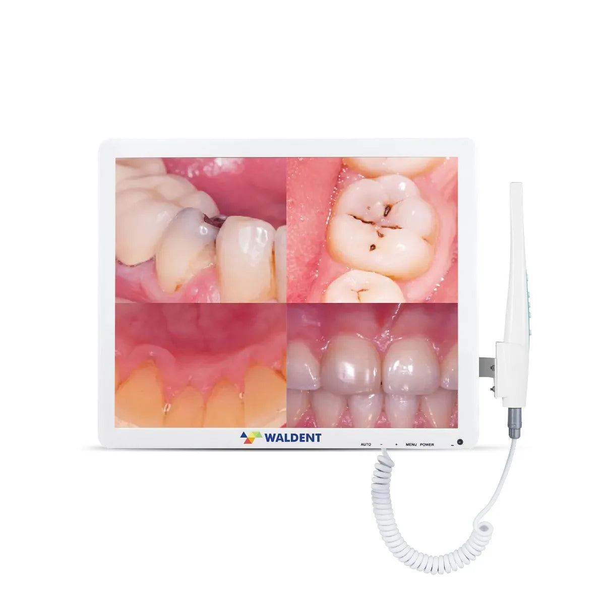 intra oral camera