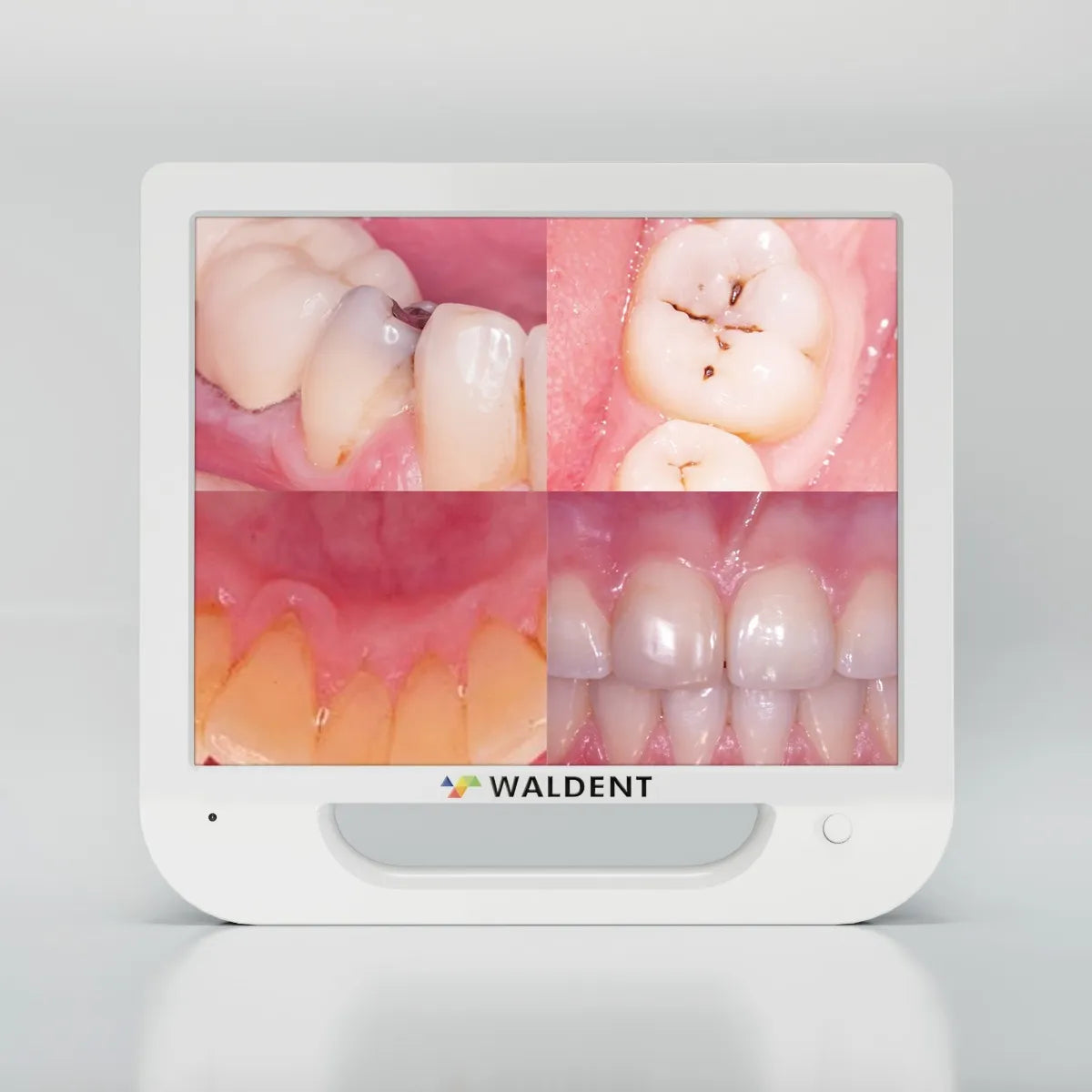 Waldent Intra Oral Camera with Screen - Ergo (10 MP)