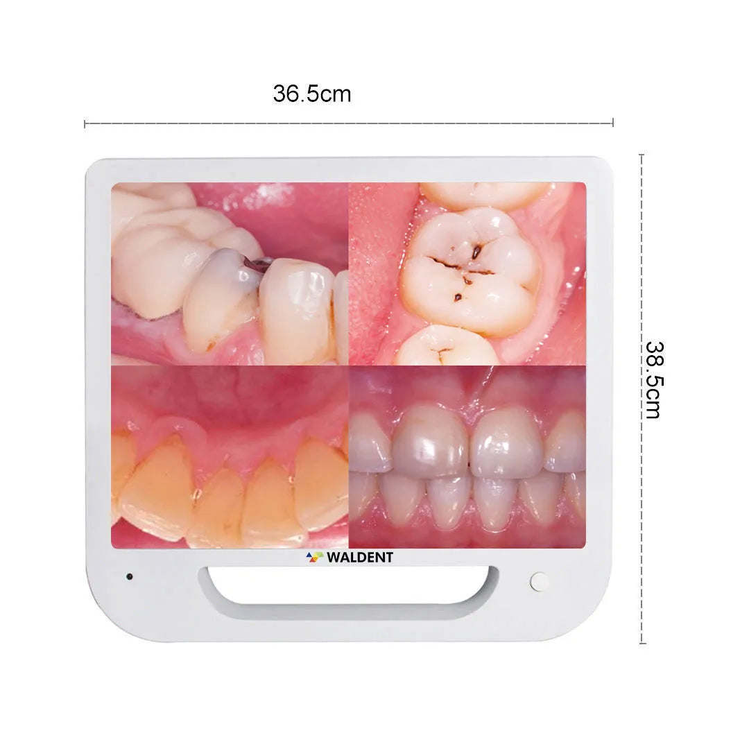 Waldent Intra Oral Camera with Screen - Ergo (10 MP)